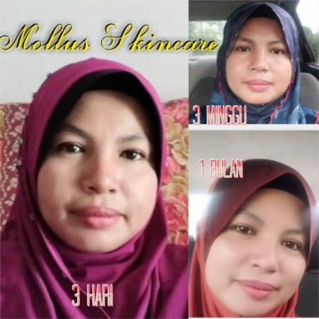 Testimoni 10