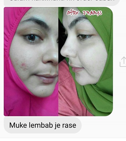 Testimoni 13