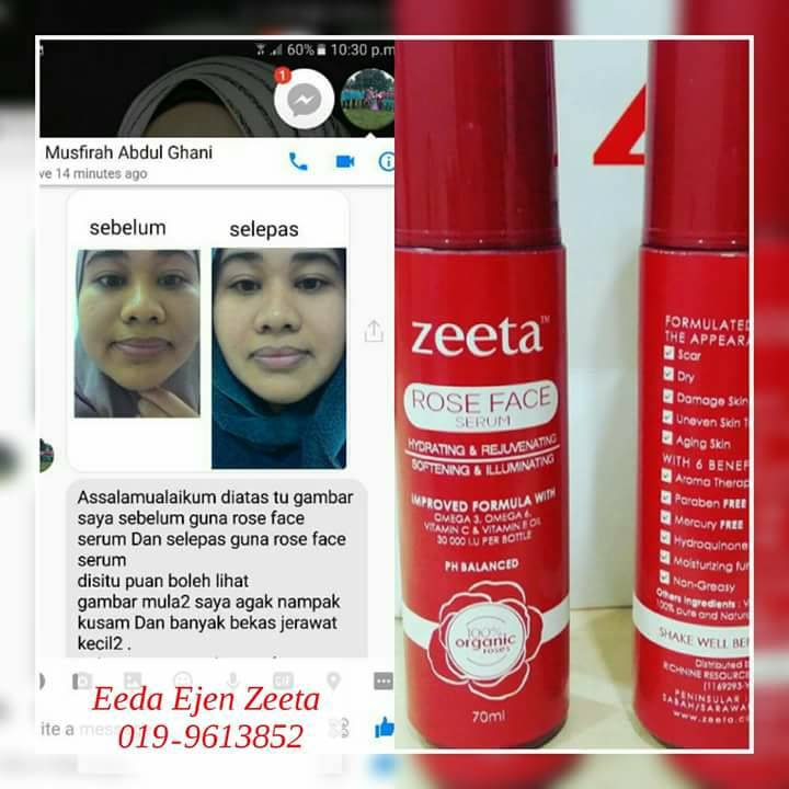 Testimoni Rose Face Serum